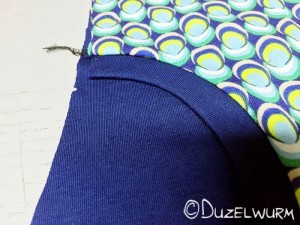 Eingrifftasche detailbild